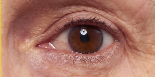 After using Sensational Eyes: visibly smoother under-eye skin